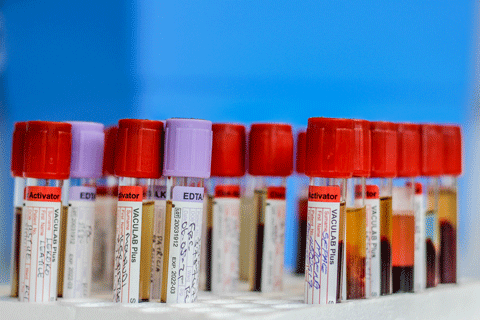 BLOOD TESTS