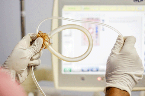 KIDNEY BIOPSY